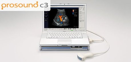 Ультразвуковой сканер Aloka Prosound C3