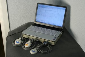Фетальный монитор с анализом КТГ Уникос - 01, 02, 03 (ноутбук/моноблок)