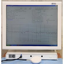 Фетальный монитор с анализом КТГ Уникос - 01, 02, 03 (ноутбук/моноблок)